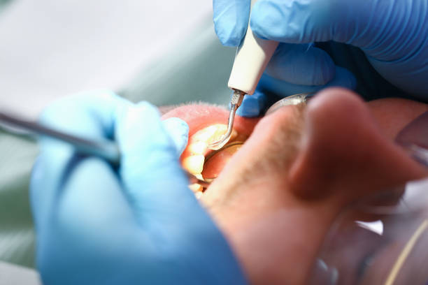 Best Emergency Treatment for Toothache in Willacoochee, GA